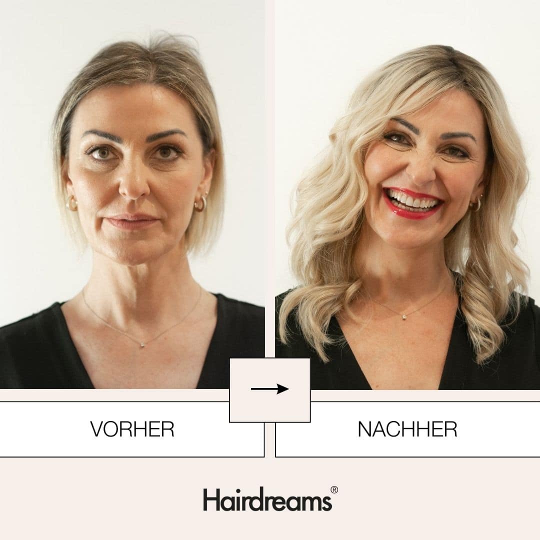 Haarverdichtung -Heardreams Microlines I Mickartz Hair