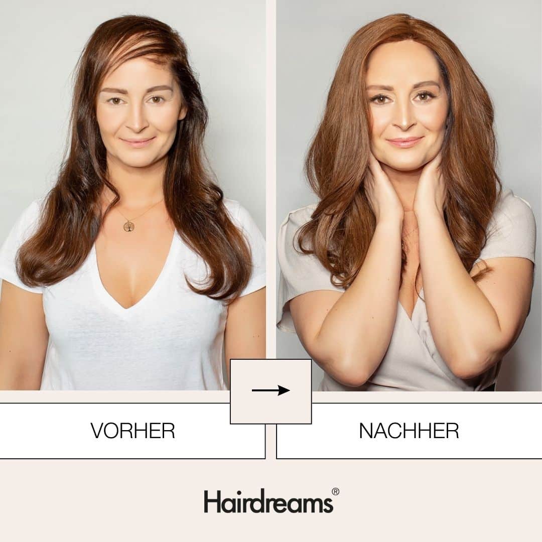 Haarverdichtung -Heardreams Microlines I Mickartz Hair