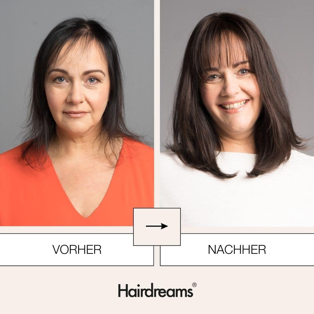 Haarverdichtung -Heardreams Microlines I Mickartz Hair