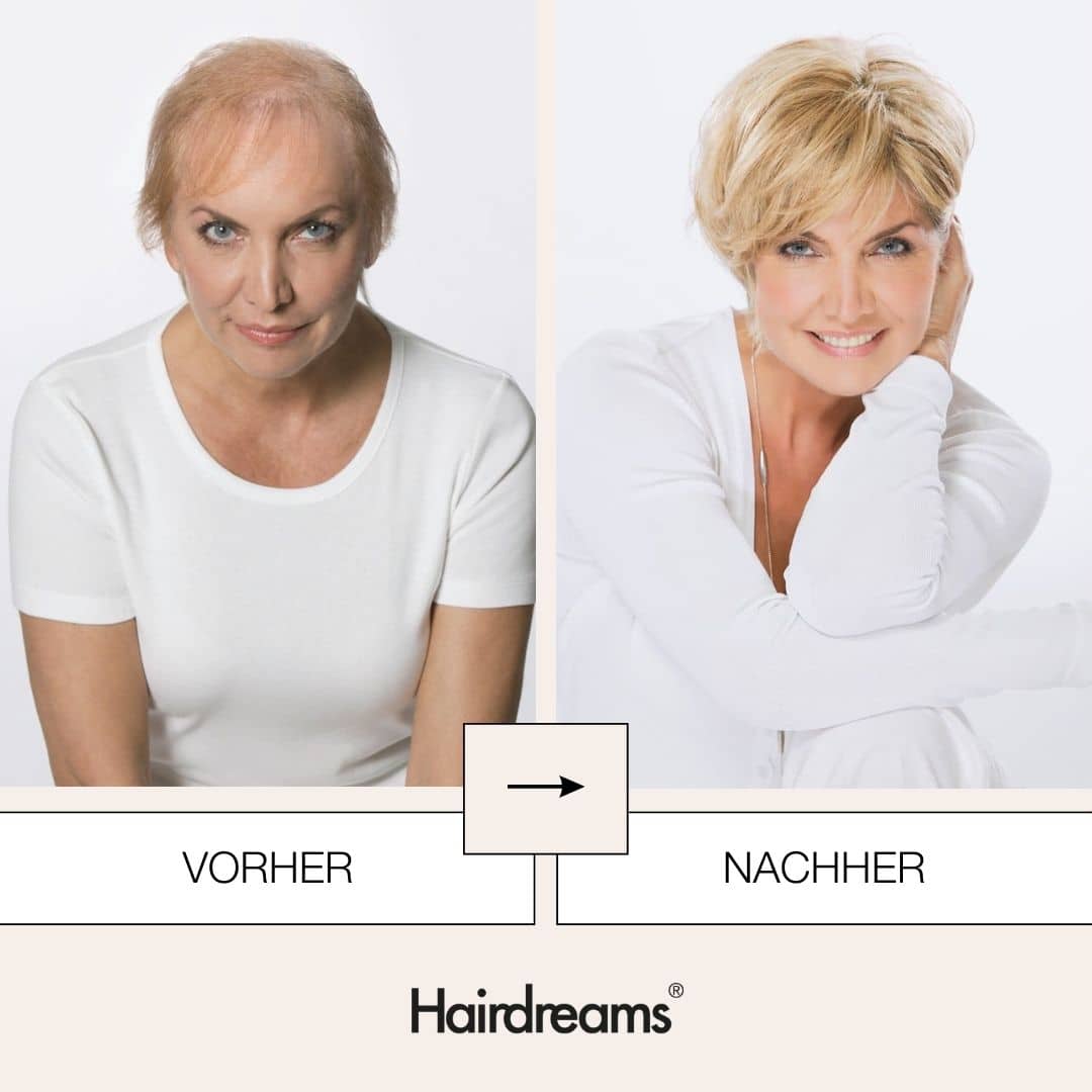 Haarverdichtung -Heardreams Microlines I Mickartz Hair